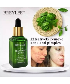 BREYLEE Acne Treatment Serum